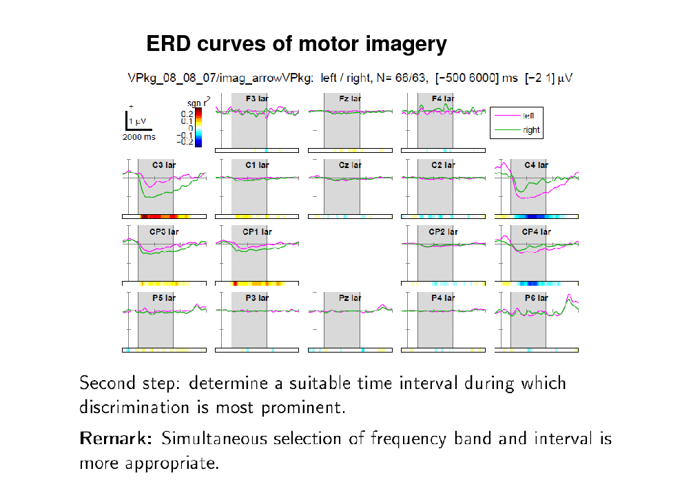 Slide: ERD curves of motor imagery

