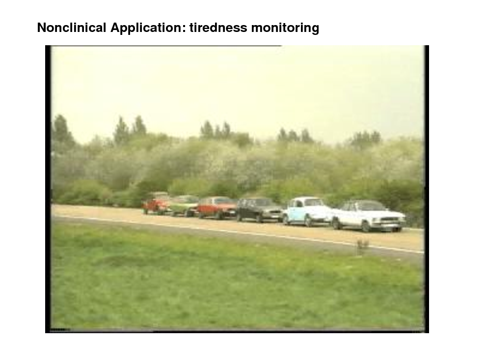 Slide: Nonclinical Application: tiredness monitoring

[Kohlmorgen, Mller et al 2007]

