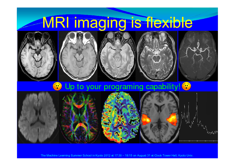 Slide: MRI imaging is flexible

Up to your programing capability!

The Machine Learning Summer School in Kyoto 2012 at 17:30  18:15 on August 31 at Clock Tower Hall, Kyoto Univ.

