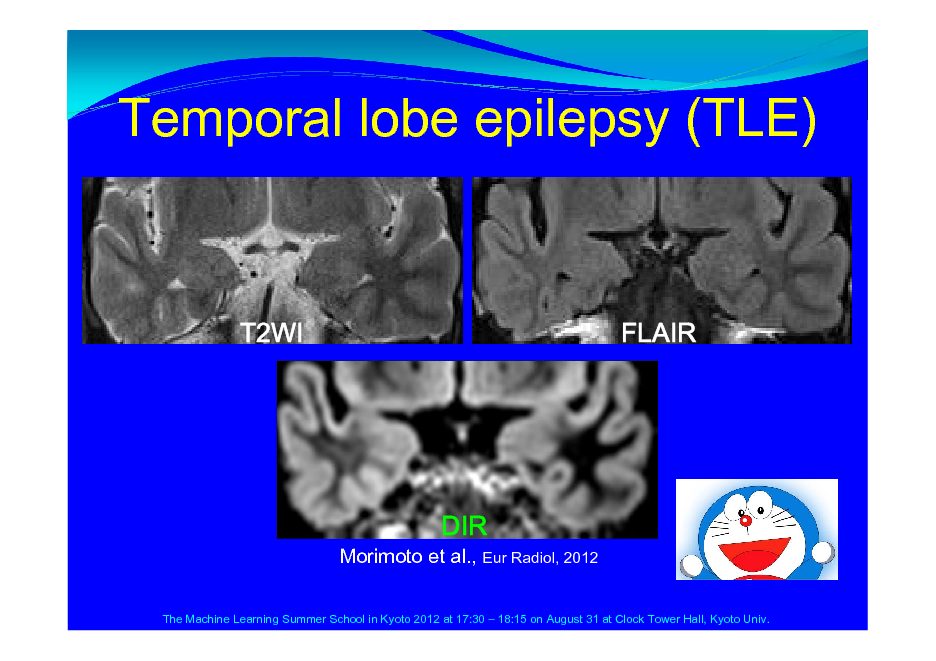 Slide: Temporal lobe epilepsy (TLE)

T2WI

FLAIR

Morimoto et al., Eur Radiol, 2012
The Machine Learning Summer School in Kyoto 2012 at 17:30  18:15 on August 31 at Clock Tower Hall, Kyoto Univ.

DIR

