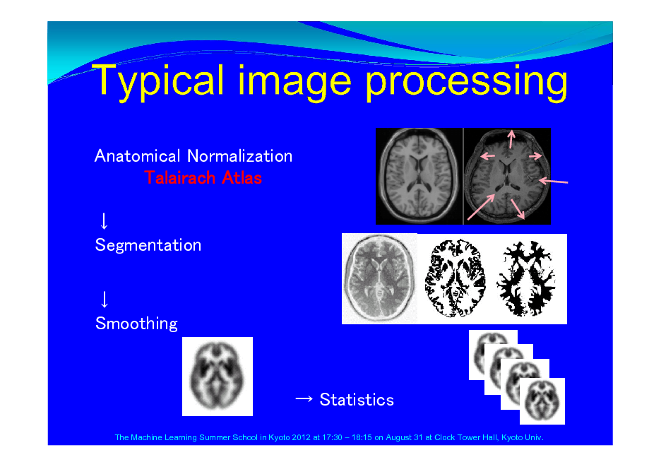Slide: Anatomical Normalization Talairach Atlas  Segmentation  Smoothing

 Statistics
The Machine Learning Summer School in Kyoto 2012 at 17:30  18:15 on August 31 at Clock Tower Hall, Kyoto Univ.

