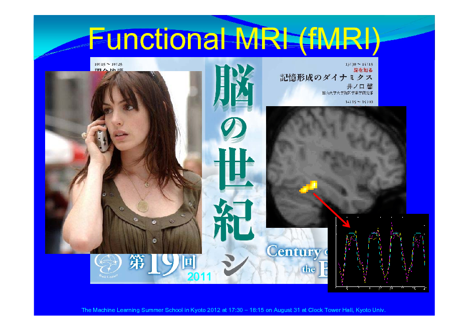 Slide: Functional MRI (fMRI)

2011
The Machine Learning Summer School in Kyoto 2012 at 17:30  18:15 on August 31 at Clock Tower Hall, Kyoto Univ.

