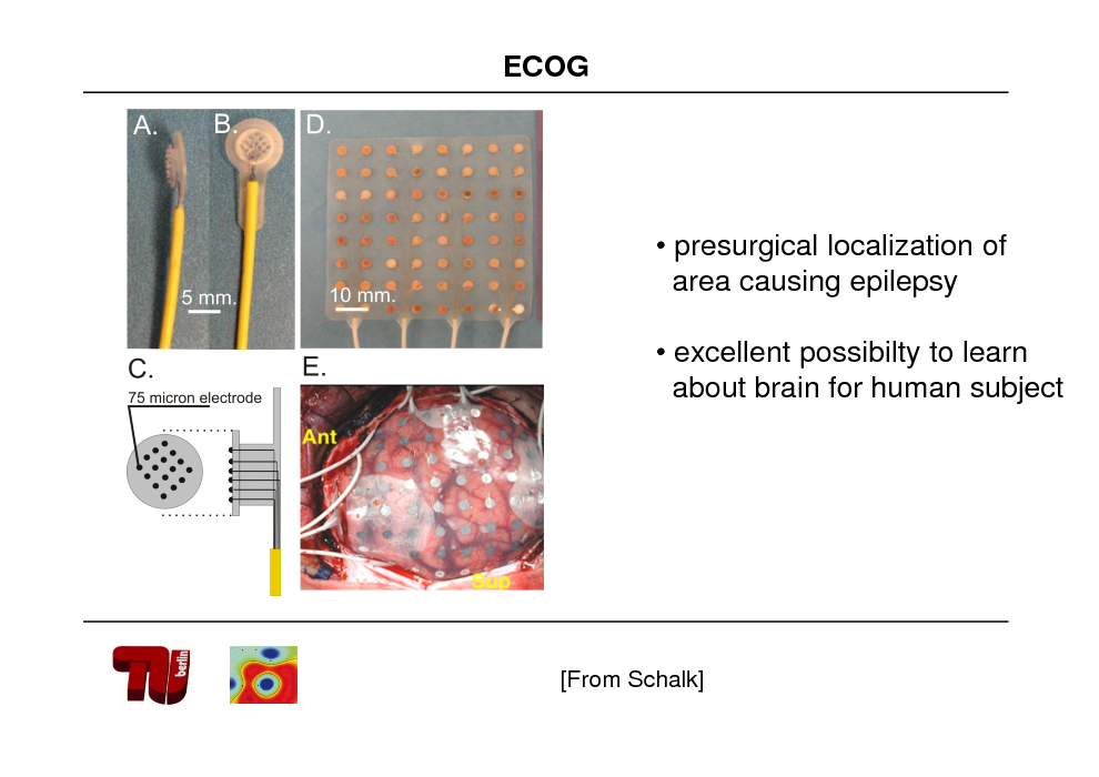 Slide: ECOG

 presurgical localization of area causing epilepsy

 excellent possibilty to learn about brain for human subject

[From Schalk]

