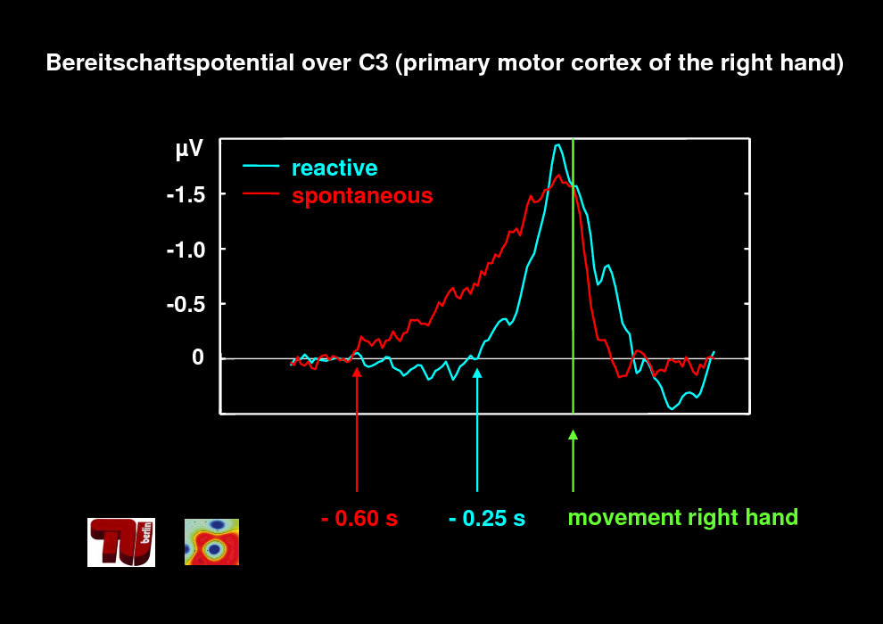 Slide: Bereitschaftspotential over C3 (primary motor cortex of the right hand)

V -1.5 -1.0 -0.5 0

reactive spontaneous

- 0.60 s

- 0.25 s

movement right hand

